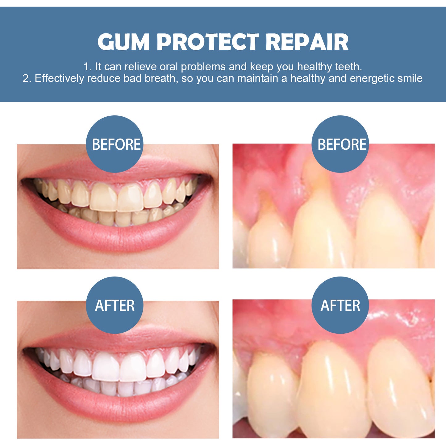 Gum Repair Tooth Cleaner